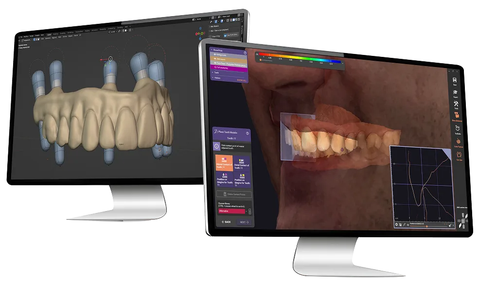Zwei Monitore mit einer Implantatbrücke und einem Smile Design auf einem Gesichtsscan