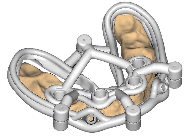 About 4 Surgical Guide dima 3D