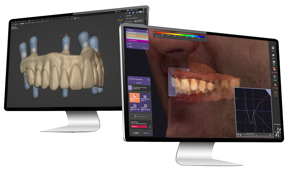Training 1 Double monitor with exocad and blender screen