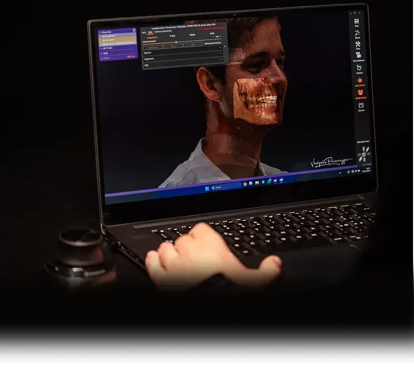 About 3 Laptop with exocad screen