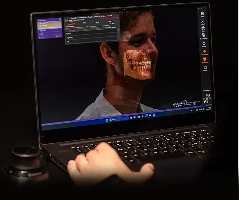 wokstation exocad facescan